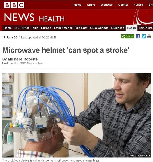 Špeciálna helma dokáže rozpoznať príznaky cievnej mozgovej príhody. (Foto: screenshot bbc.com)
