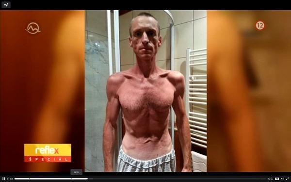 Košičan po 35. dňoch hladovania. Údajne nemal vtedy žiadny tuk. (Foto: screenshot videoarchiv. markiza.sk)