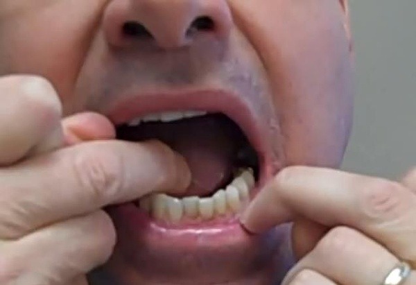 Správna technika čistenia zubov