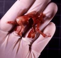 Kontroverzná kampaň s fotografiami usmrteného nenarodeného ľudského plodu sa skončí tento víkend.