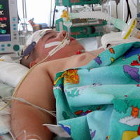 Dominik (9) leží napojený na prístroje.