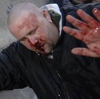 Jeden z pravicových radikálov skončil po potýčke pri právnickej fakulte v blízkosti pražského Židovského mesta s rozbitým nosom.