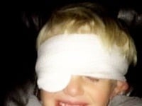 Chlapcovi ošetrovali ranu na čele: Namiesto toho mu omylom zalepili oči lepidlom!