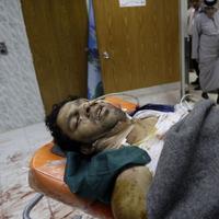 Muž zranený počas samovražedného atentátu v al-Kázimijja