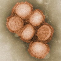 Chrípkový vírus A/H1N1.
