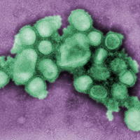 Prasacia chrípka alebo po novom Novel flu virus.