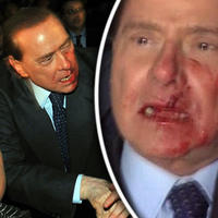 Zakrvavený Silvio Berlusconi