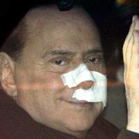 Berlusconi po prepustení z nemocnice.
