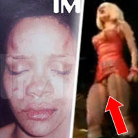 Zbitá Rihanna a Lady Gaga s penisom