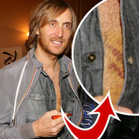 David Guetta mal poriadne modriny na hrudi.