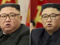 Najnovšie FOTO Kim Čong-una vyrážajú dych: Vážna choroba! Diktátorovo odôvodnenie zmeny vizáže