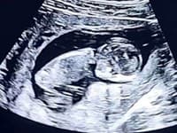 NEPLÁNOVANÉ tehotenstvo známej Slovenky: Prehovorila o pohlaví bábätka... Chcela by TOTO!