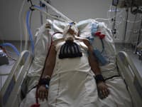 Najdlhšie hospitalizovaný pacient s COVIDOM-19: Už tretí rok je v nemocnici, nakazil sa spolu s bratom