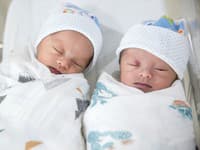 Jednovaječné dvojčatá vyrastali v odlišných krajinách: Šokujúce rozdiely, toto zistili o sestre žijúcej v USA