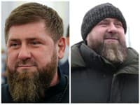 Čo sa to deje s čečenským vodcom? Putinov verný nekontrolovateľne priberá, Kadyrov je asi chorý, špekuluje sa