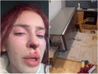DRSNÉ obvinenia slovenskej miss: Krv, rozbité dvere, zdemolovaný byt... TOTO jej mal spôsobiť známy FRAJER!