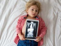 Chlapcovi (5) zröntgenovali brucho: To, čo našli v jeho žalúdku, im vyrazilo dych