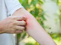Chorvátsko bojuje proti invazívnym komárom vypúšťaním neplodných jedincov