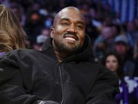 Kanye West opäť šokoval: Nosí titánovú zubnú protézu... Z jej ceny sa vám zatočí hlava!