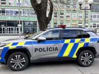 Polícia obvinila muža (55): Napadol iného muža s nožom v ruke