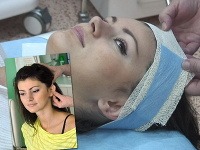 Miss Universe SR 2011 Kolesárová podstúpila operáciu odstávajúcich uší.