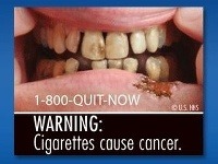 Varovanie: Cigarety spôsobujú rakovinu