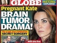 Podľa zahraničného plátku vojvodkyňa z Cambridge trpí vážnym ochorením mozgu.