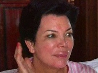Kris Jenner sa zobudila s opuchnutými ústami a šokovala celú rodinu Kardashianových.
