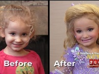 Pred a po zmene vizáže, ktorú musia dievčatká kvôli kontroverznej súťaži podstúpiť