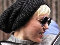 Miley Cyrus trápia veľké zapálené vyrážky.