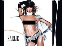 Krásnu modelku Karlie Kloss znetvorili nepodarenou retušou v oblasti podpazušia.