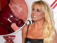 Britney Spears sa doširoka usmievala napriek bolestivým ranám na chodidle.