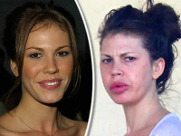 Nikki Cox v roku 2002 a v súčasnosti Nikki Cox v roku 2002 a v súčasnosti