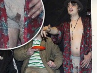 Pete Doherty prekvapil so špinavými trenkami, ktoré v oblasti intímnych partií pôsobili zakrvaveným dojmom.