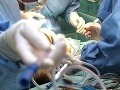 Českí lekári uskutočnili prvú reťazovú transplantáciu obličiek!