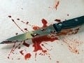 Brutálni tínedžeri zmlátili a dorezali muža (27), kvôli mobilu!