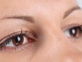 Obľúbené očné kvapky už v lekárňach nenájdete: Spolu s týmto ich kontrola zrušila!