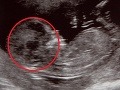 Strašidelný detail na ultrazvuku: Na syna hľadel z FOTO jeho mŕtvy otec!