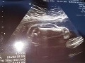 Manžel skoro spadol z nôh, keď uvidel FOTO bábätka z ultrazvuku: Moja žena otehotnela s...!