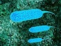 Smrtiaca Hurghada: V letovisku vlani zomreli britskí manželia, údajne na E. coli, teraz tam vypukla epidémia!