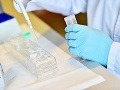Slováci vymysleli unikátny test DNA: Oslovil aj zahraničné laboratóriá, stoja za ním mladí vedci
