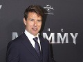 Zranený Tom Cruise sa vôbec nešetrí: Chce opäť nakrúcať!