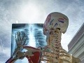 Transplantačný koordinátor s odkazom Transplantačný koordinátor s odkazom