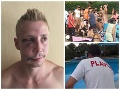 Plavčík prehovoril o krvavej dráme na kúpalisku: Je to tam peklo, FOTO zmláteného Davida (25)