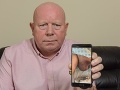 FOTO Nočná mora každého muža: Hasičovi (54) museli amputovať penis, podcenil drobnú vyrážku