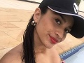 Tínedžerka (16) sa nechala potetovať: Odvtedy prežíva peklo, zažila dve obrovské rany za sebou