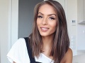 Známa Češka sa konečne dostala z popálenín: Teraz prišla o chlapa!