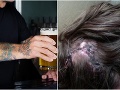 Kateřinu a Jana napadli Kateřinu a Jana napadli
