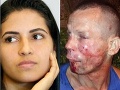 Lupič chcel obrať krásku (26) o mobil: Zápasníčka UFC mu dala príučku, FOTO dobitého muža