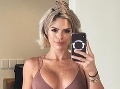 Kuriózna nehoda sexi modelky: Na pláži s uhryznutým zadkom!